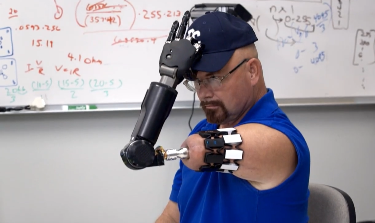 Here's the World's Most Advanced Bionic Arm