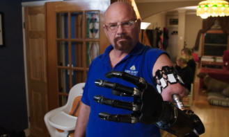 Here's the World's Most Advanced Bionic Arm