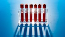 Blood Test for Cancer
