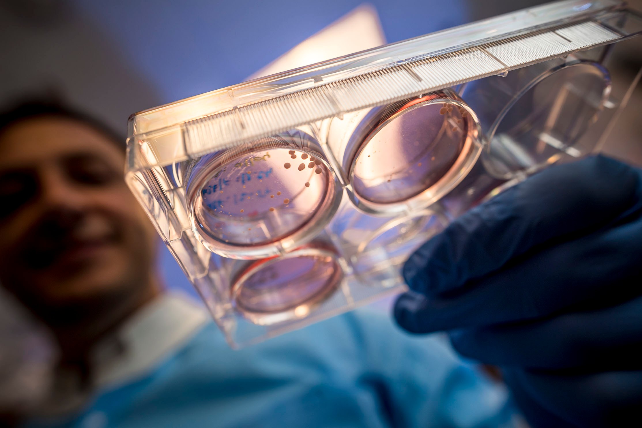 Scientists grew a mini brain in a lab. It has human-like brain waves.