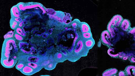 brain organoids