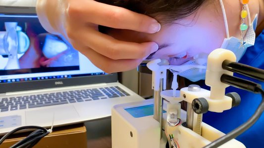 contact lens robot