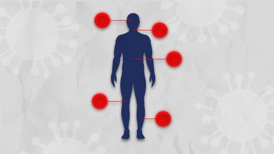 what are the coronavirus symptoms