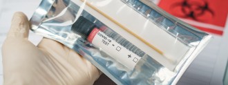 CRISPR-Based Coronavirus Test