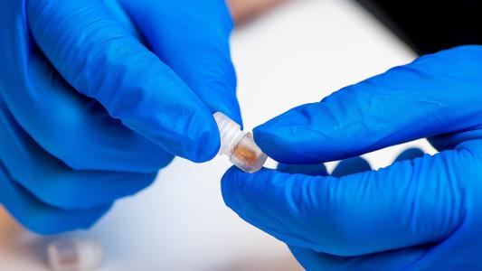 Gut Microbiome