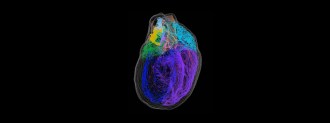 3D heart model