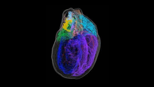 3D heart model