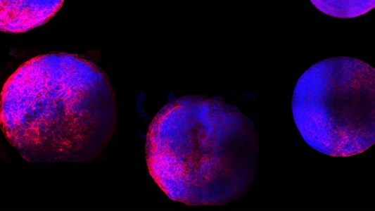 heart organoids