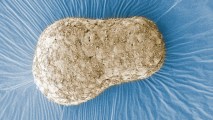 Human Embryo