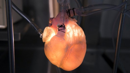manufacturing Human Organs