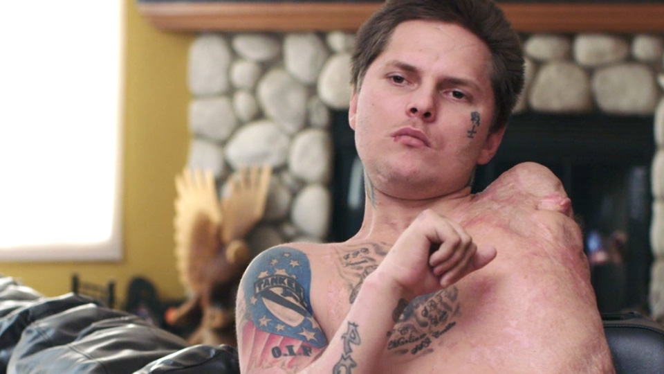 Jerral Hancock Wounded Veteran with Bionics