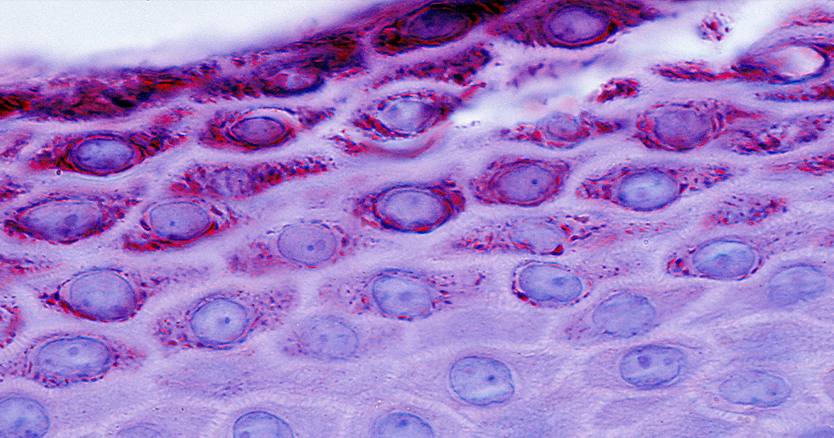 Skin cells deals