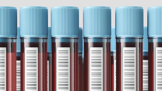 New Blood Test for Cancer