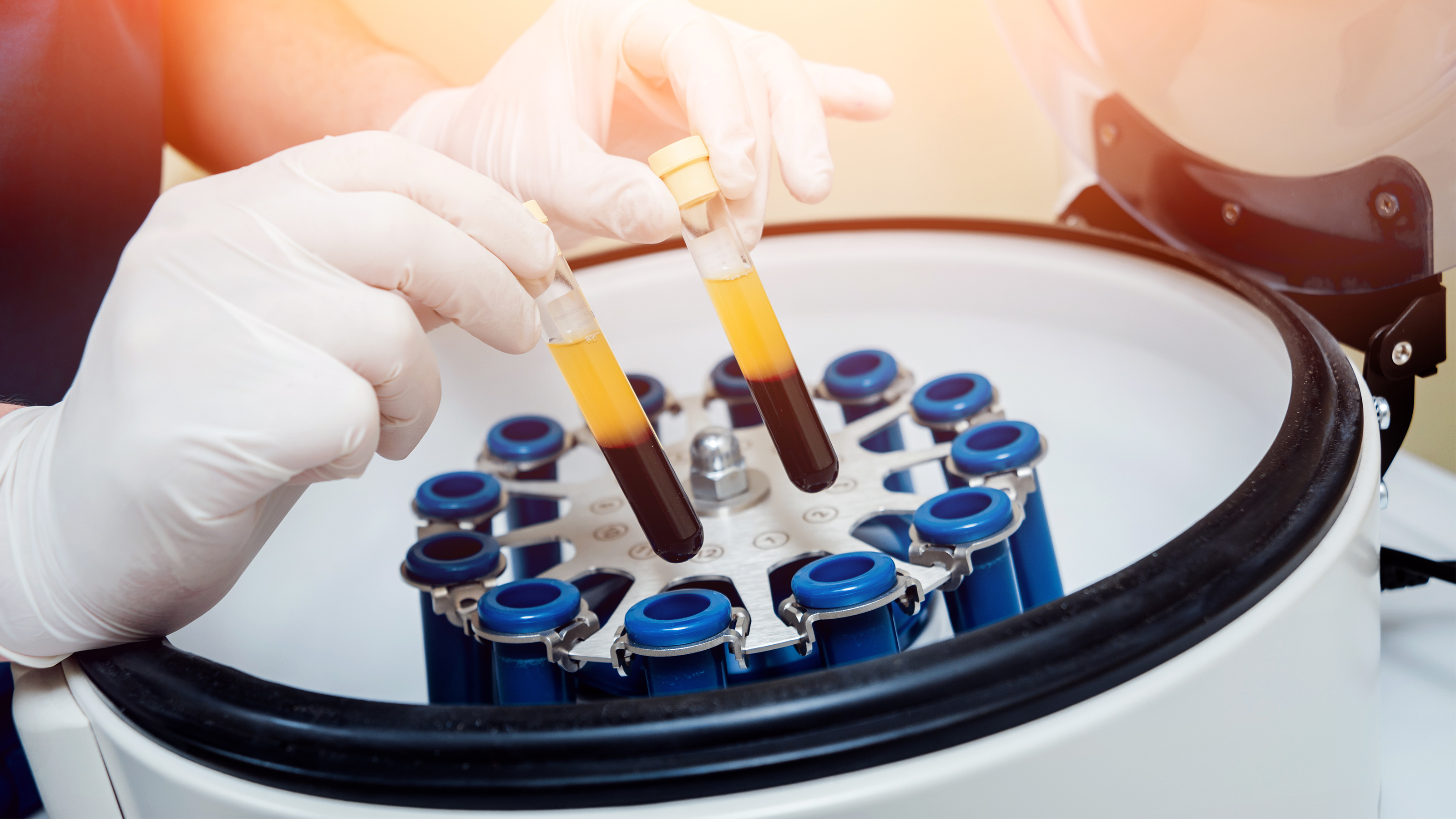 Plasma from Coronavirus Survivors