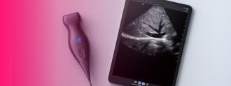 Portable Ultrasound Machine