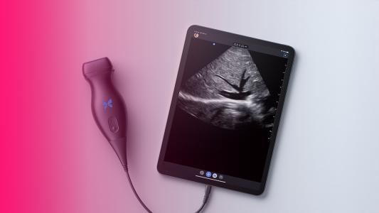 Portable Ultrasound Machine