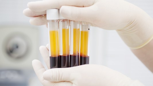 Prevent Coronavirus