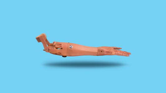 prosthetic arm