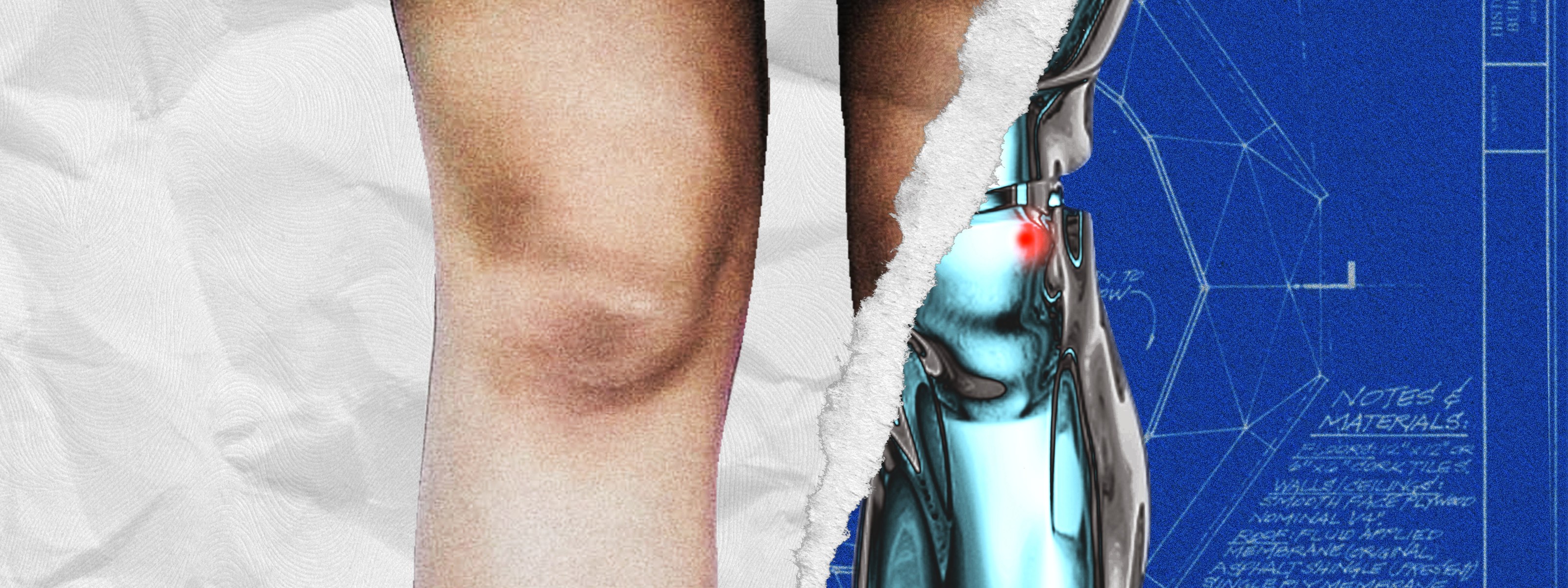 Building an artificially intelligent, open-source prosthetic leg