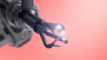 robotic surgery