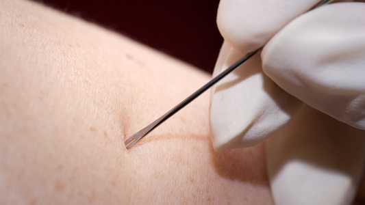 scarification vaccination