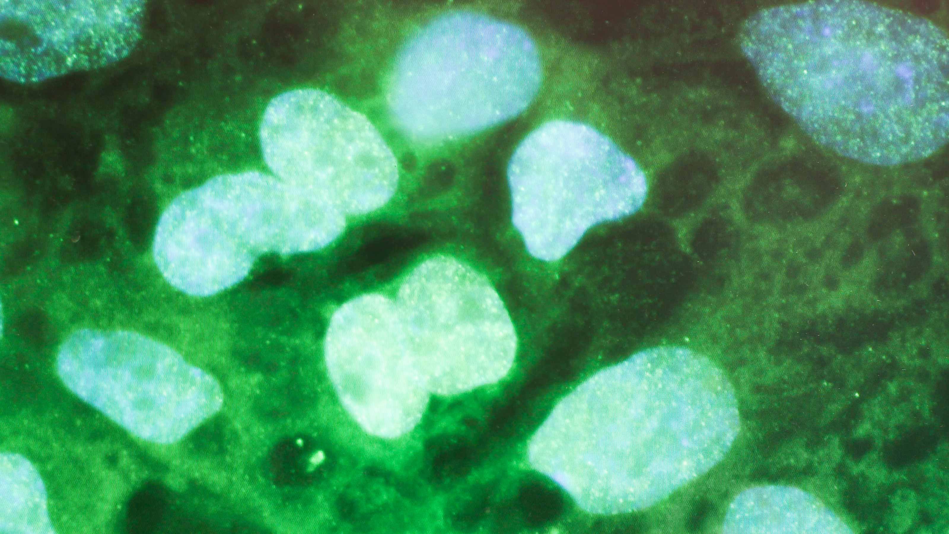 stem cell treatment for covid-19