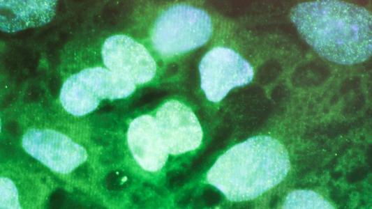 stem cell treatment for covid-19