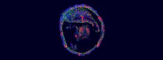 Tear Gland Organoids