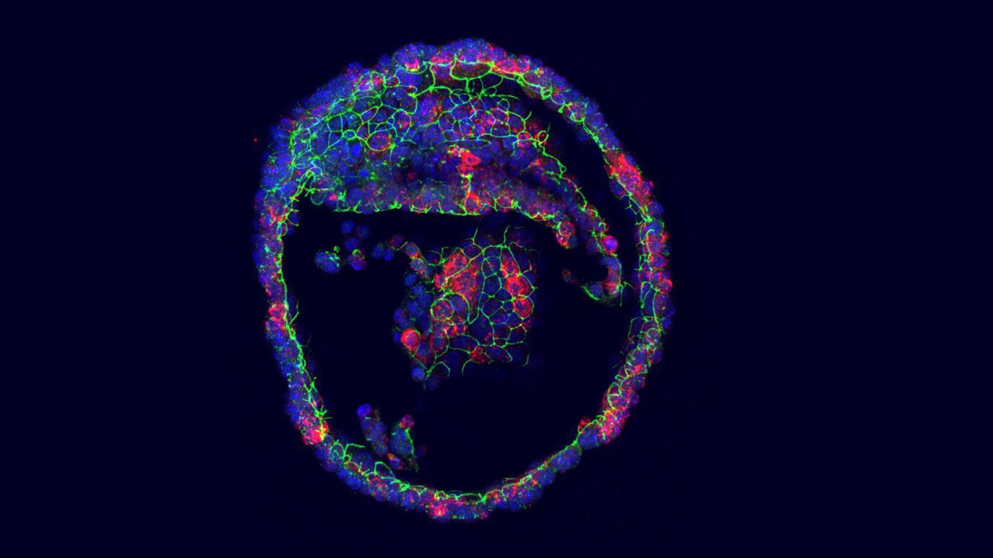 Tear Gland Organoids