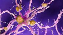 Test for Alzheimer’s