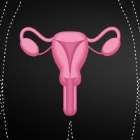 Uterus Transplant