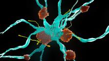 Alzheimer's drug aducanumab