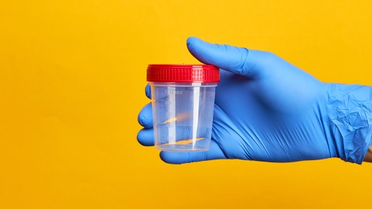 urine test for brain cancer
