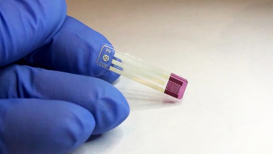 diabetes test