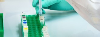 HIV Vaccine Trial