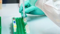 HIV Vaccine Trial
