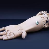 prosthetic arm