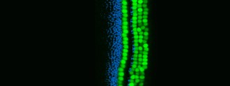 hearing loss
