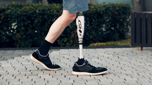 prosthetic limbs