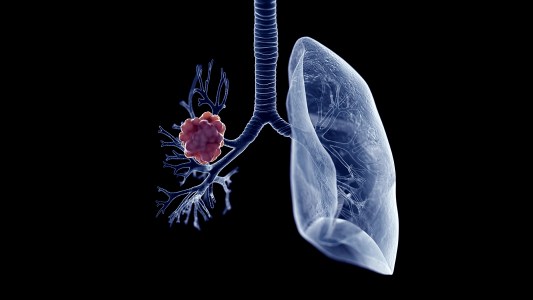 lung cancer blood test