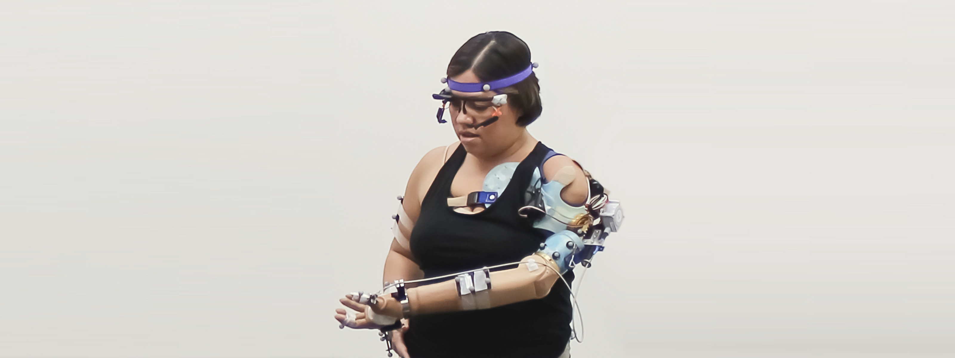 New bionic arm is incredibly close to the real thing