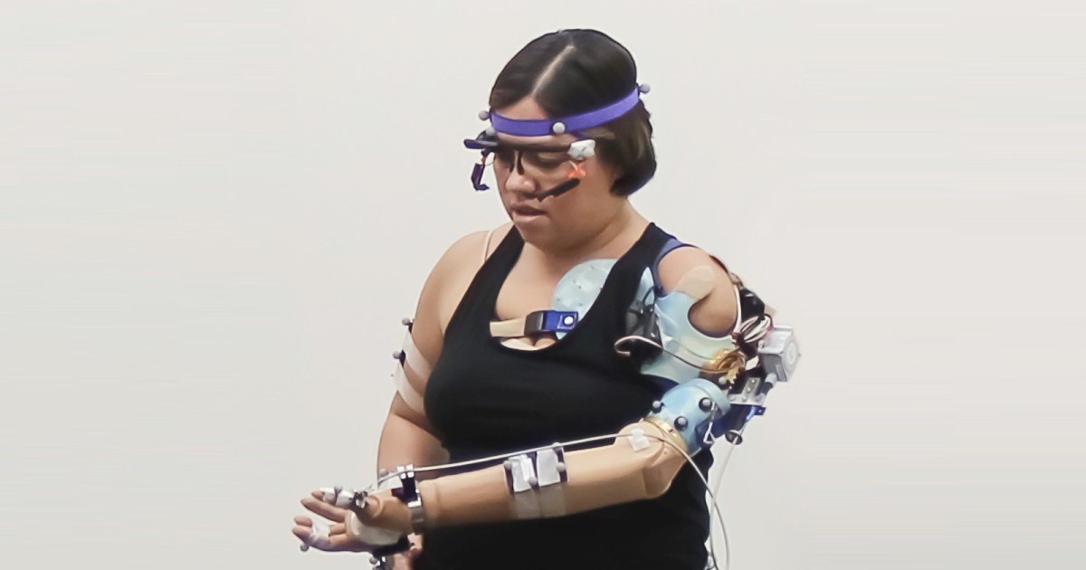 New bionic arm is incredibly close to the real thing