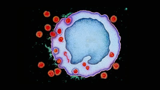 hiv treatment