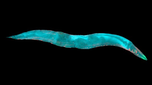 pancreatic cancer screening
