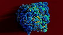 woman cured of HIV