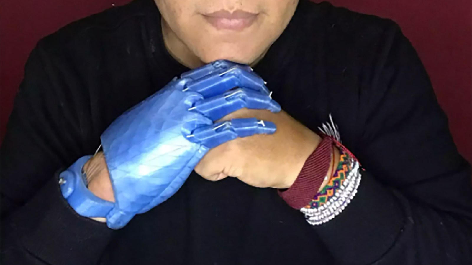 Man builds his own bionic hand out of melted plastic bottles