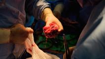 pig-to-human heart transplant