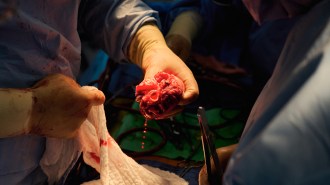pig-to-human heart transplant