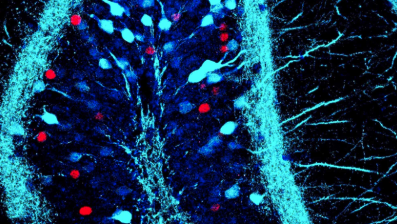Good and bad memories are stored in different neurons, study finds