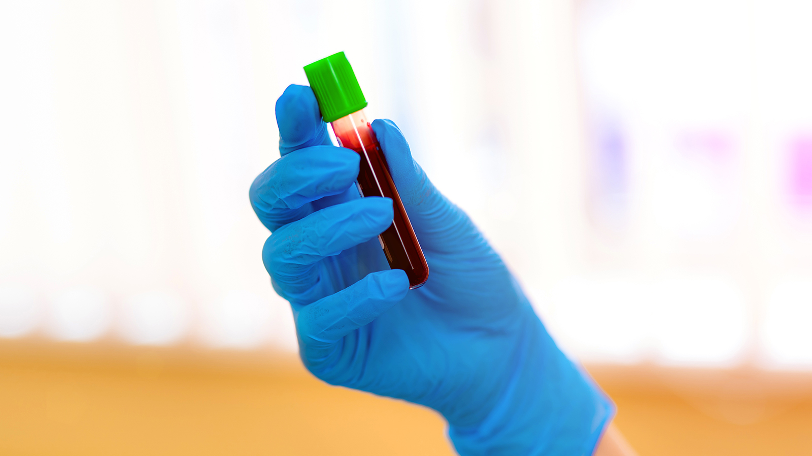 hemophilia b treatment